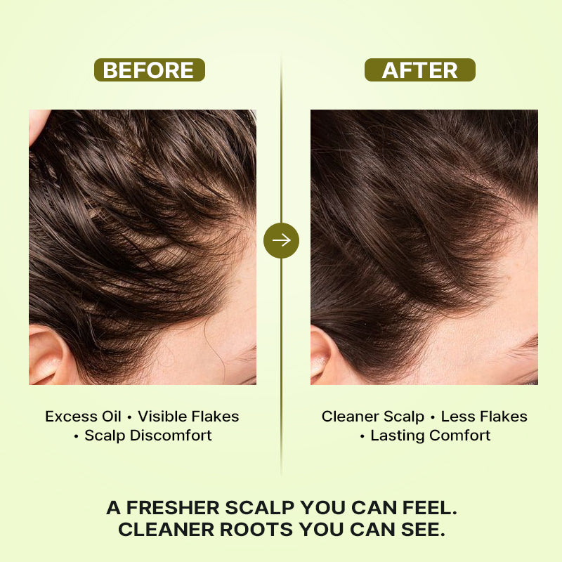 Lador Tea Tree Calming Scalp Shampoo 330ml