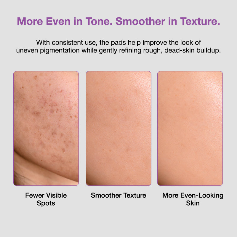 Sungboon Editor Meoru Podo Vita C Turn-Over Dark Spot Pad 140ml/60Pads