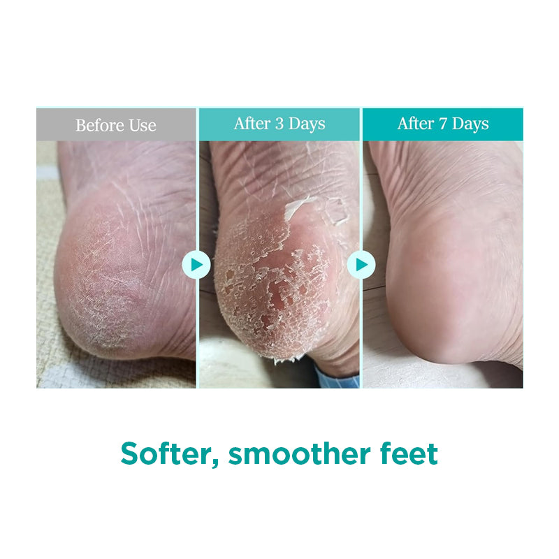 Ariul Smooth & Pure Foot Peeling Mask 34g