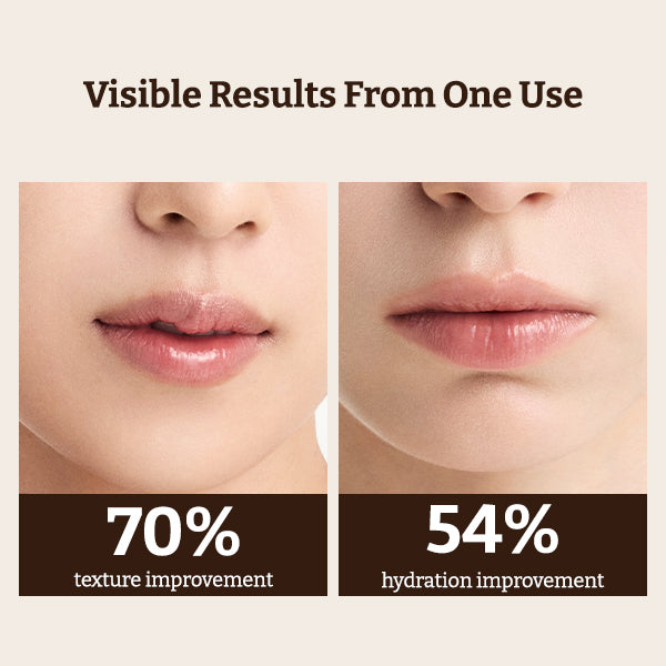 Dr.Reju-All Advanced PDRN Rejuvenating Lip Serum 10ml