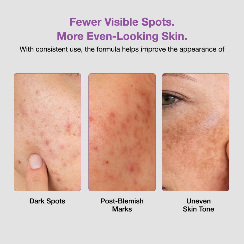 Sungboon Editor Meoru Podo Vita C Dark Spot Ampoule 30ml