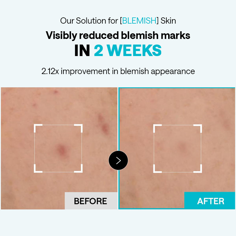 MEDIHEAL Madecassoside Blemish Pad - 170ml