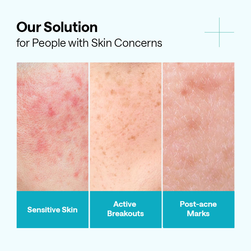 MEDIHEAL Madecassoside Blemish Repair Serum - 40ml