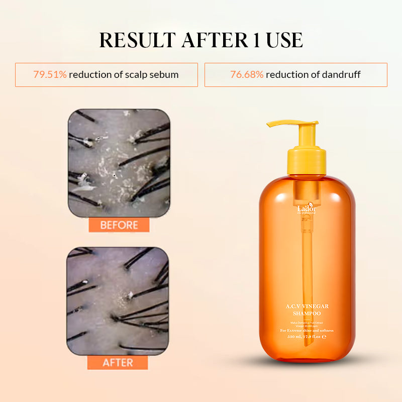 Lador ACV Vinegar Shampoo - 530ml