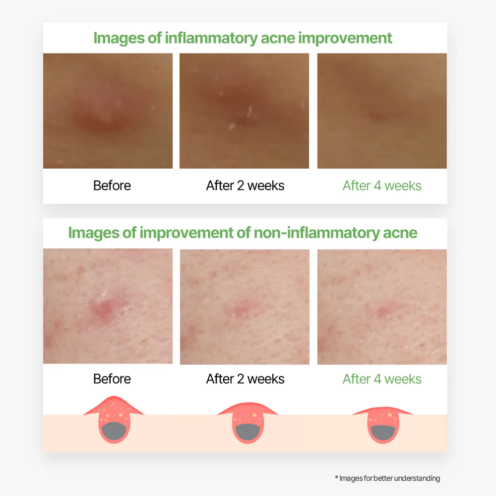 Thank you Farmer - Skin Relief SPF Twin Pack