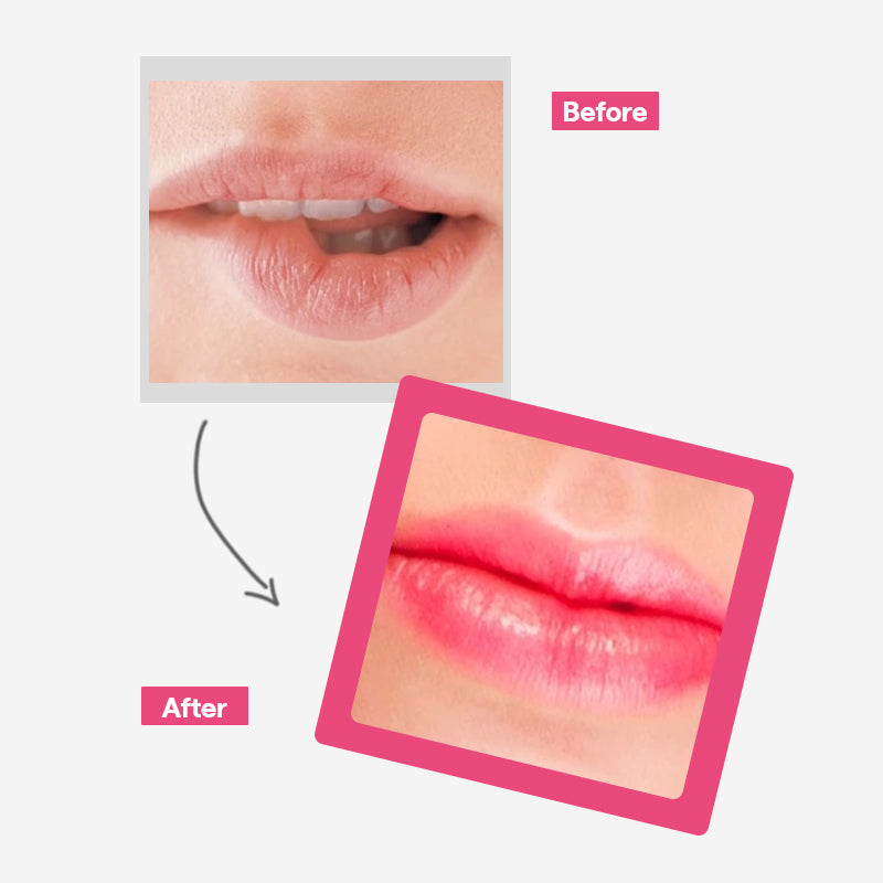 MEDIHEAL Pantenolips Essence Berrypink - 10ml