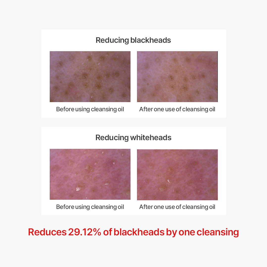 Thank You Farmer Pollufree™ Cleansing Oil - 200ml