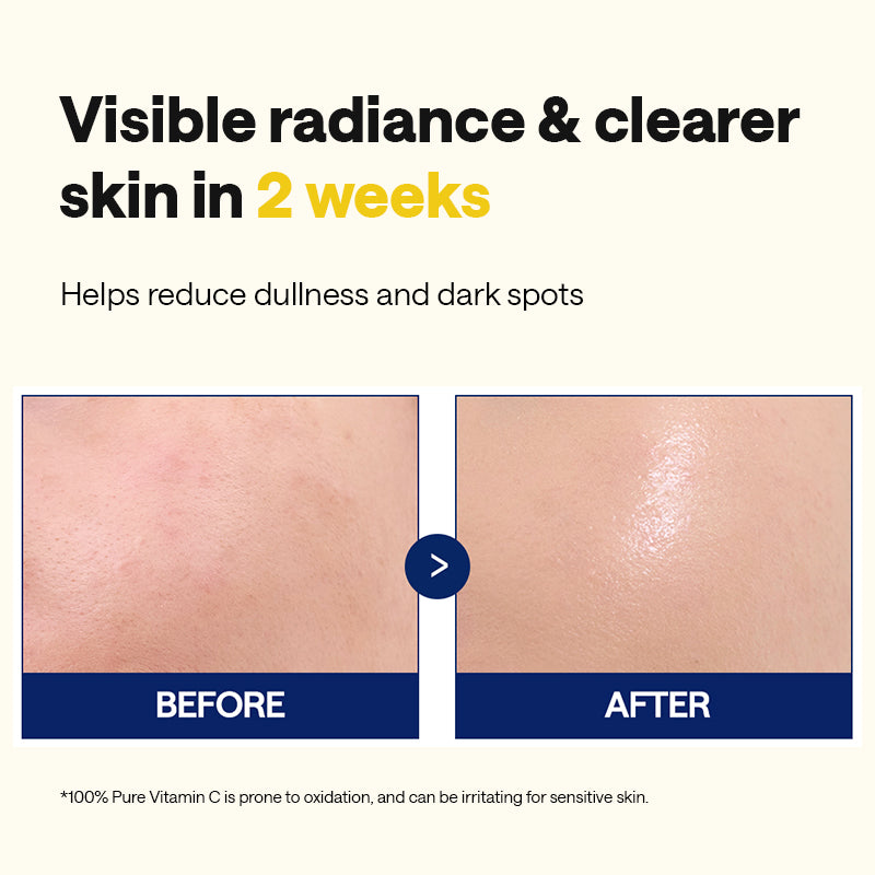 MEDIHEAL Vitamin C Brightening Serum - 40ml