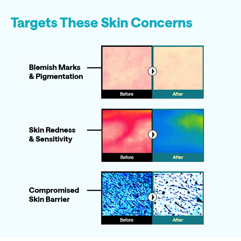 Mediheal Bestselling Mask Edit