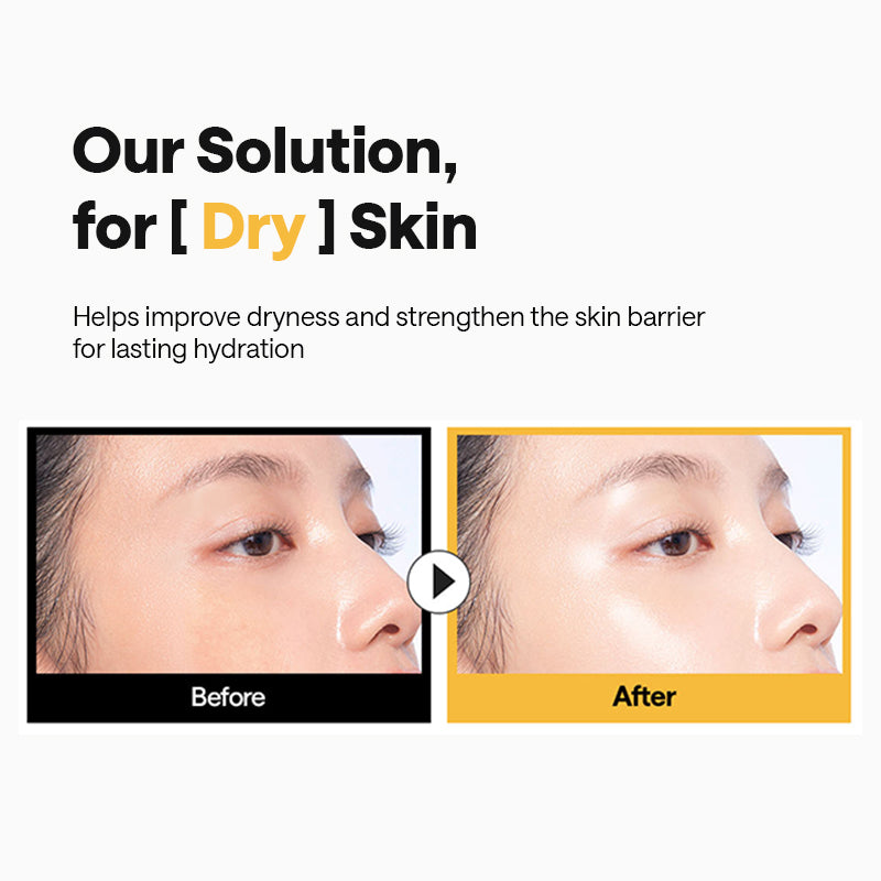 MEDIHEAL Ceramide Essential Mask Moisture Barrier - 24ml