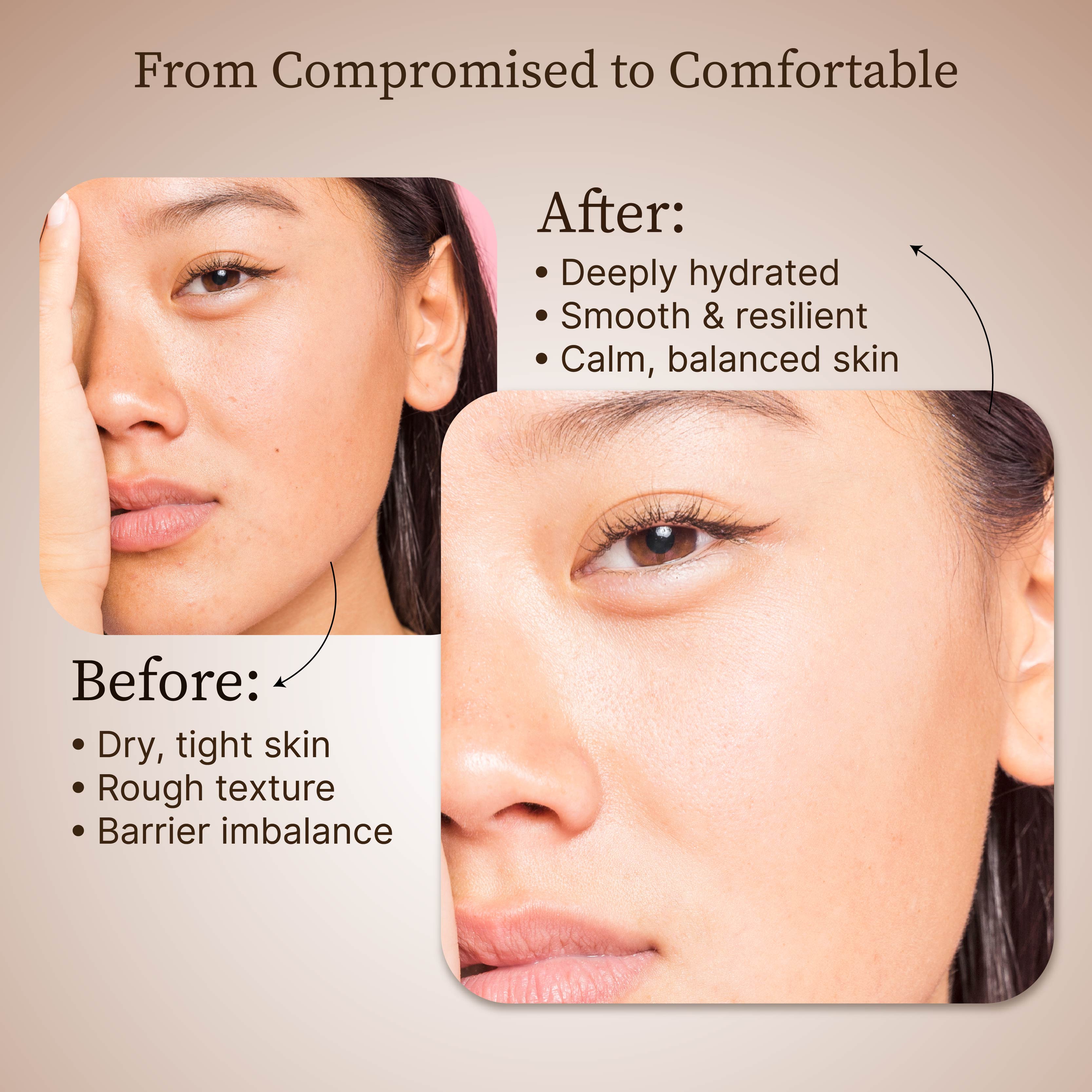 Dr.Reju-All Advanced LC-Ceramide Barrier Cream - 50ml