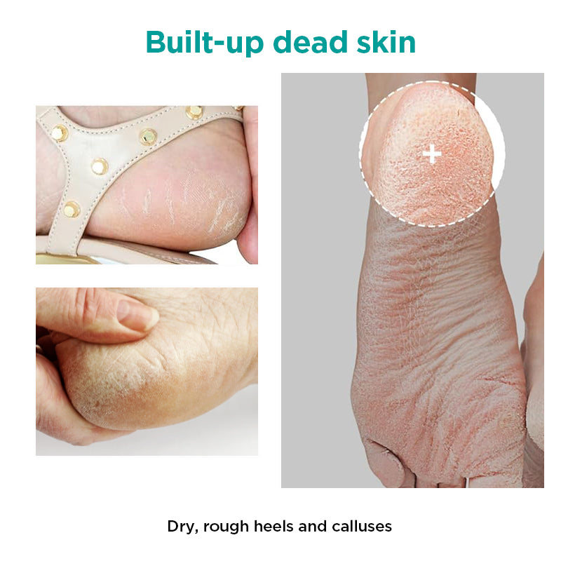 Ariul Smooth & Pure Foot Peeling Mask 34g