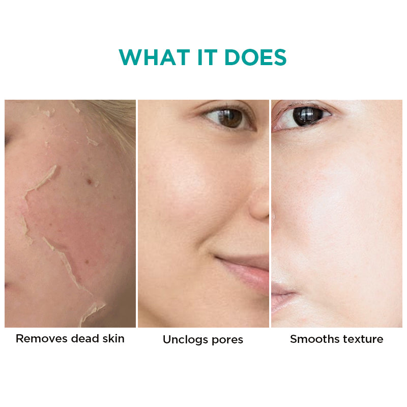 Ariul 7Days Tea Tree Peeling Pad - 150ml/ 70pads