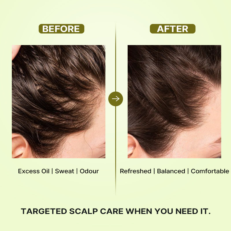 Lador Tea Tree Calming Scalp Dry Shampoo 100ml
