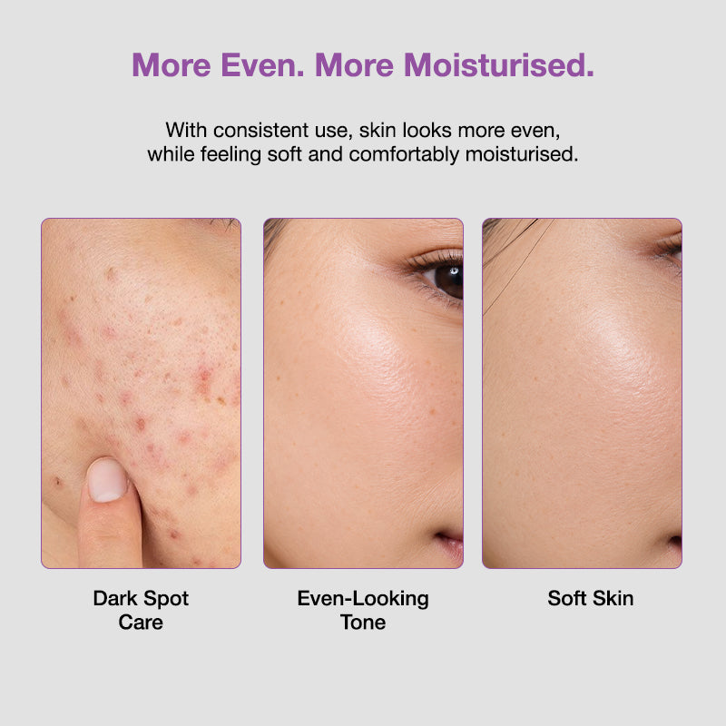Sungboon Editor Meoru Podo Vita C Dark Spot Cream 50ml