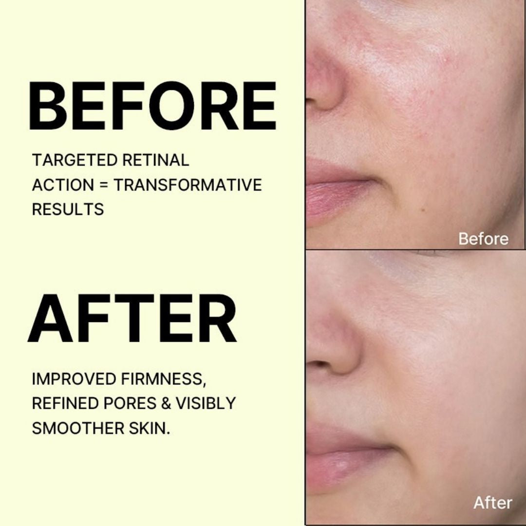 Celimax The Vita-A Retinal Shot Tightening Booster - 15ml