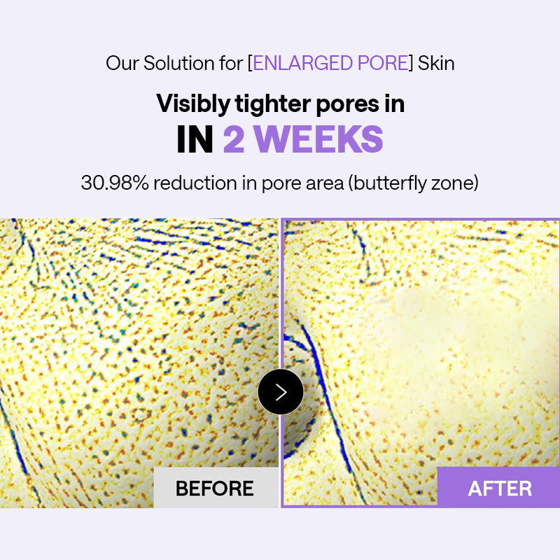 MEDIHEAL PDRN Lifting Pad - 170ml