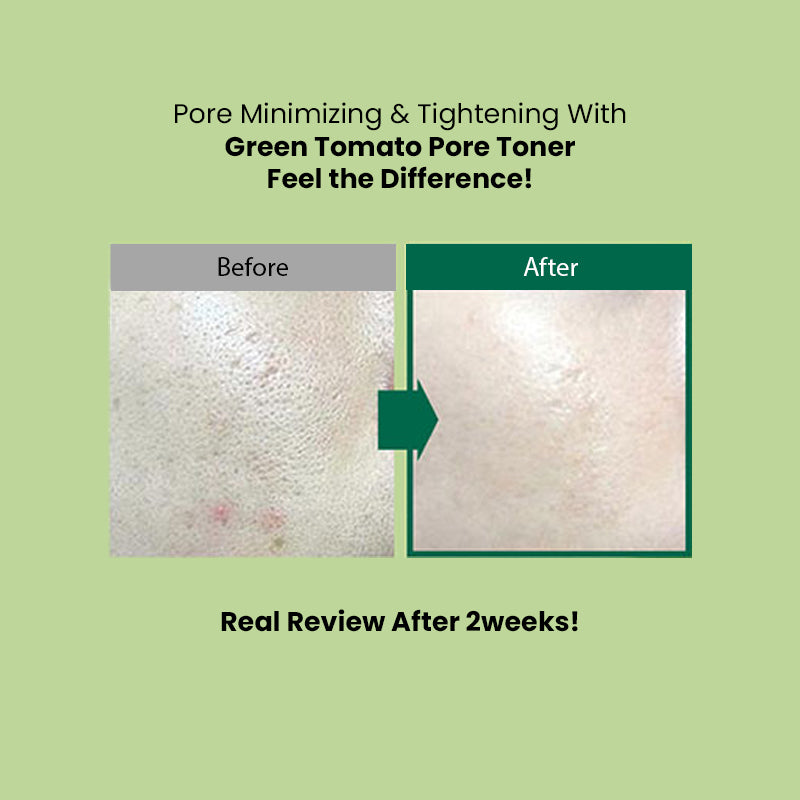 Sungboon Editor Green Tomato Pore Lifting Toner (350ml)