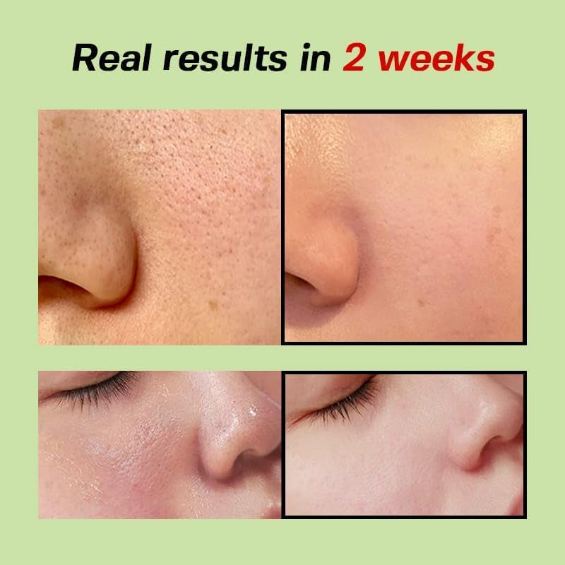 Sungboon Editor Green Tomato Pore Lifting Ampoule+ (30ml)