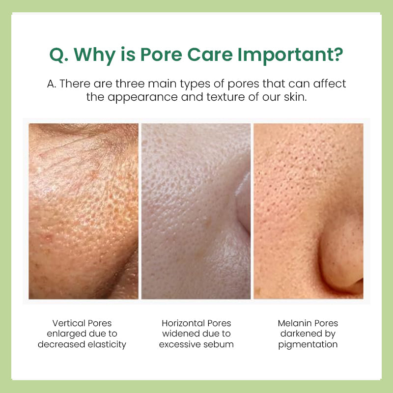 Sungboon Editor Green Tomato Pore Lifting Toner (350ml)