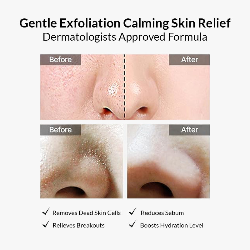 Celimax Ji Woo Gae Heartleaf Bha Peeling Pad - 60pads