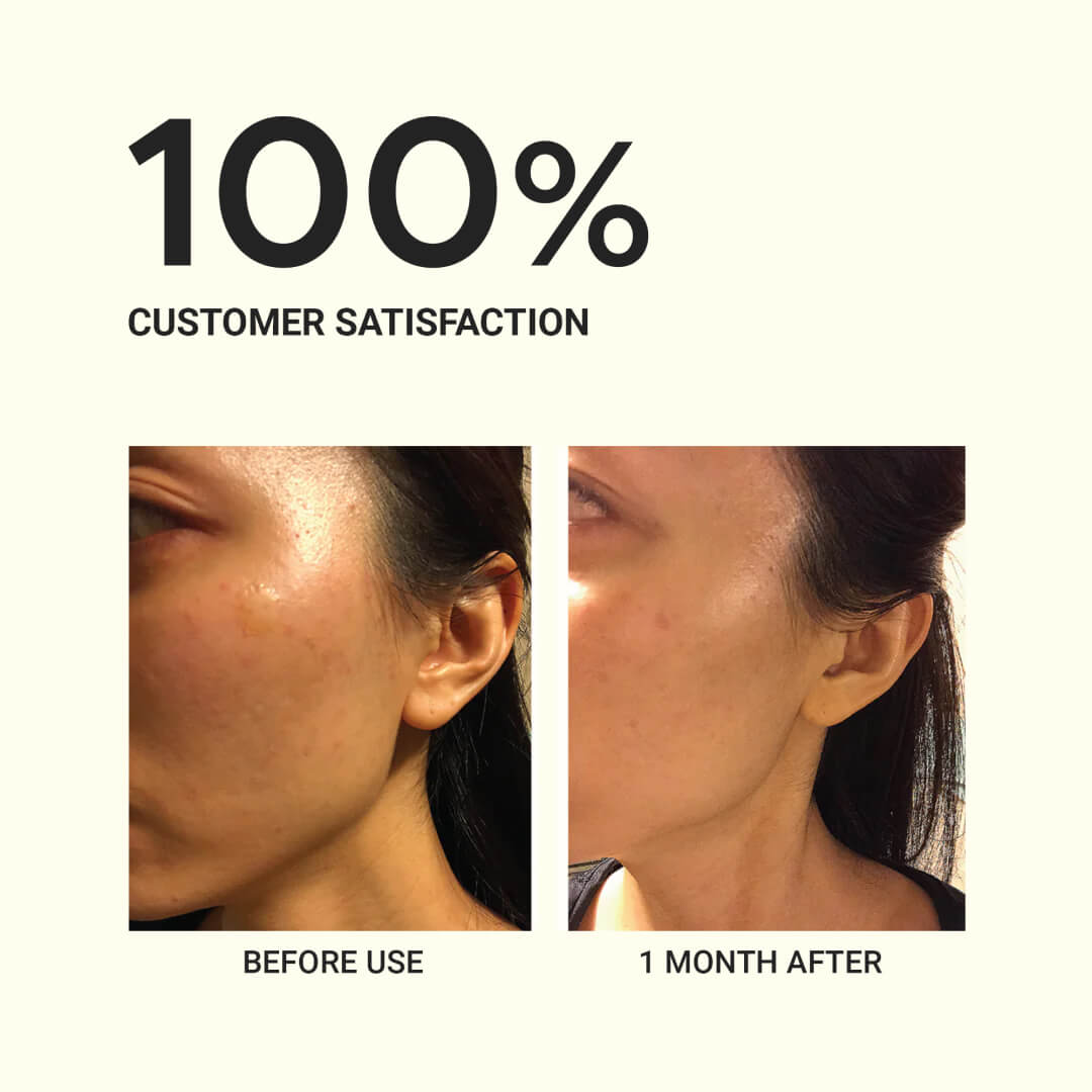 PureAm Authentic Barrier Cream Balm (Moisturizer) - 75ml, 30ml