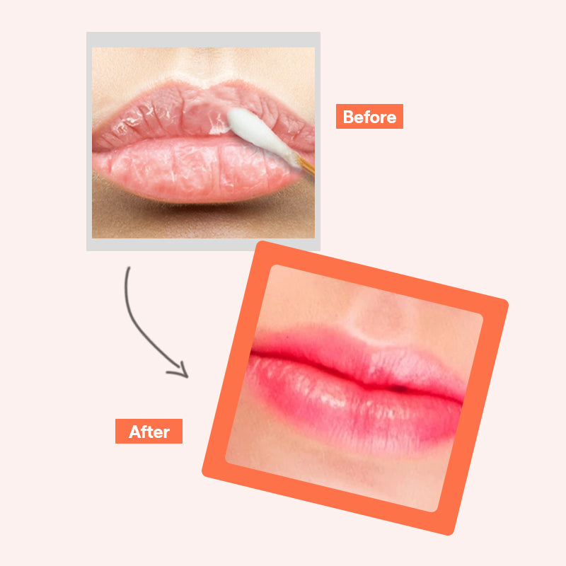 MEDIHEAL Pantenolips Healssence Coral - 10ml