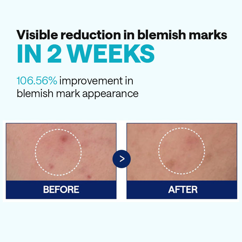 MEDIHEAL Madecassoside Blemish Repair Serum - 40ml