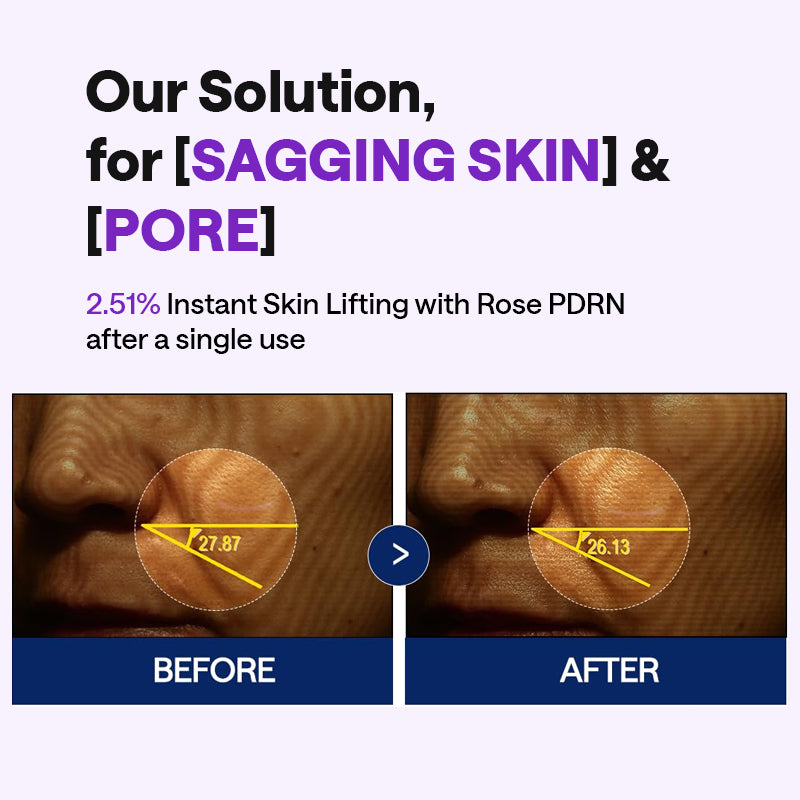 MEDIHEAL PDRN Lifting Serum - 40ml