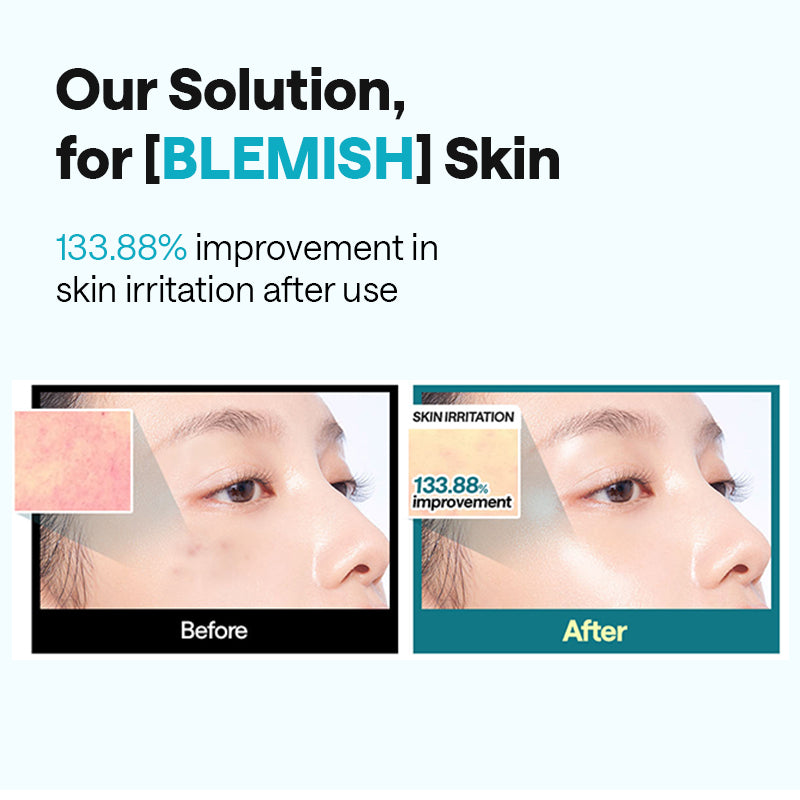 MEDIHEAL Madecassoside Essential Mask Blemish Repair - 24ml