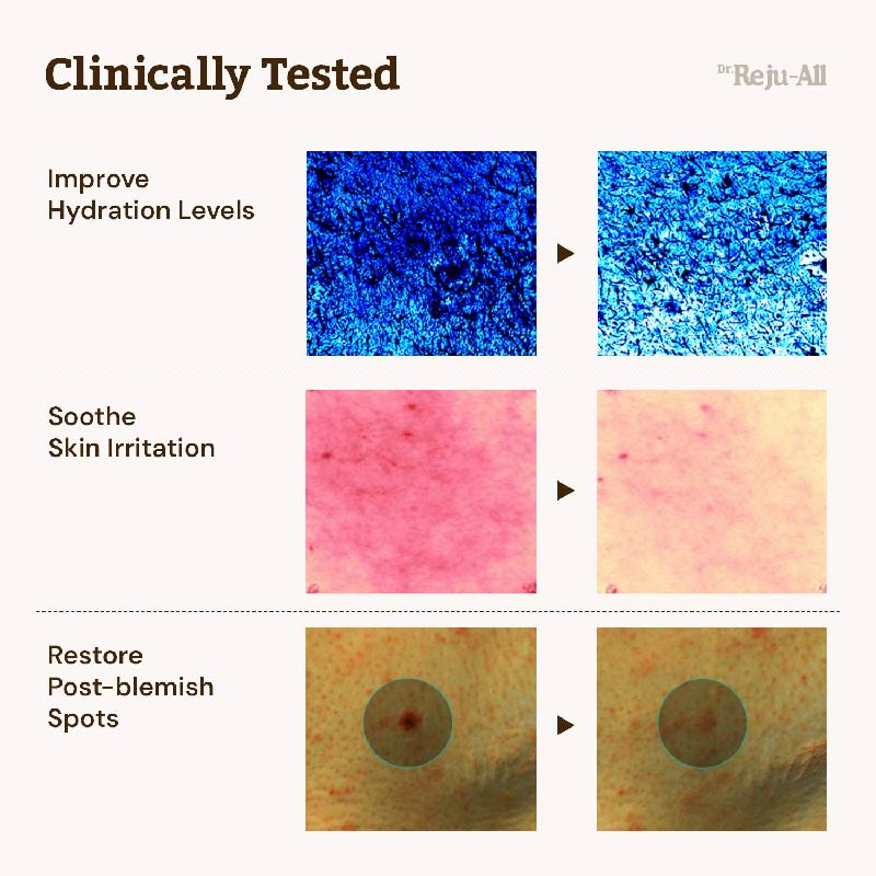 Dr.Reju-All Advanced PDRN Rejuvenating Cream - 20ml