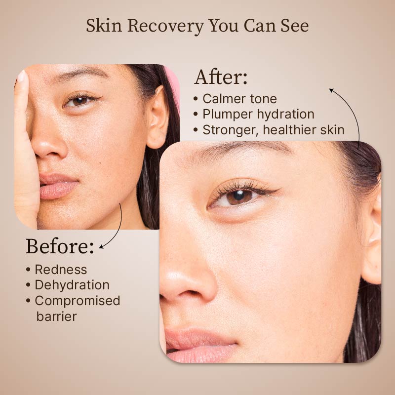 Dr.Reju-All Advanced PDRN Rejuvenating Cream - 20ml