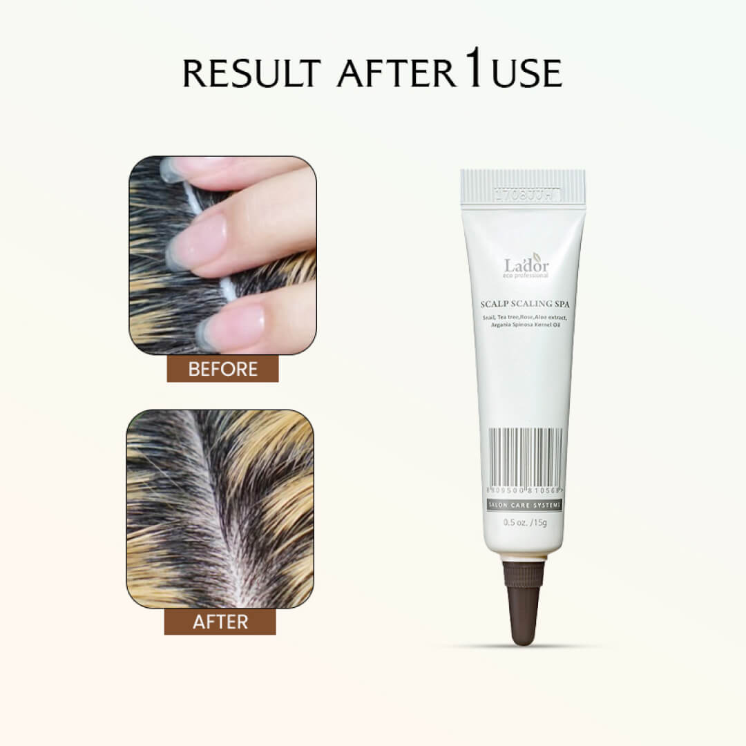 Lador Scalp Scaling Spa - Pack Options: 1 or 4