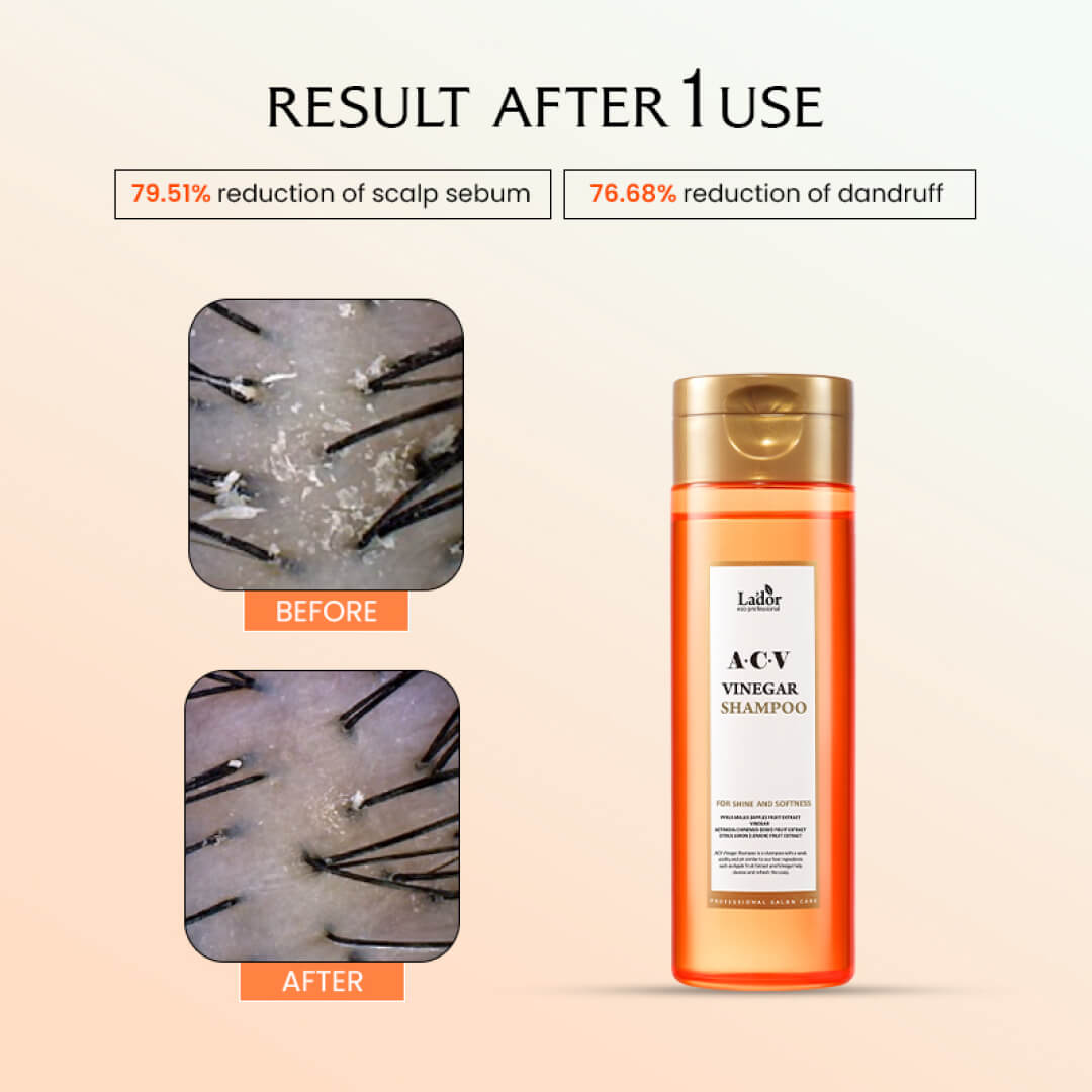 Lador ACV Vinegar Shampoo